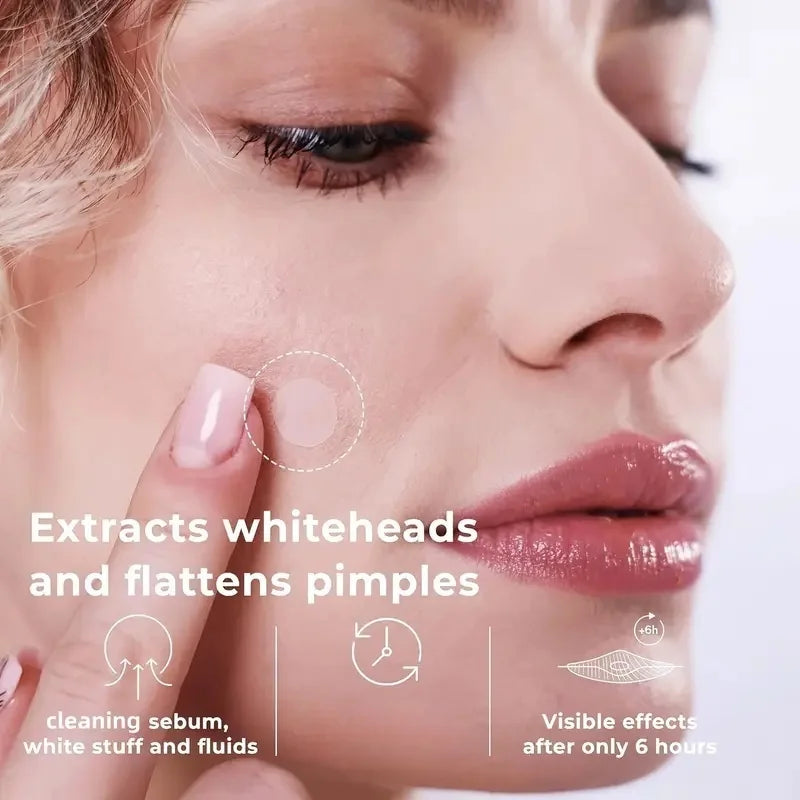 360 Acne Pimple Patches